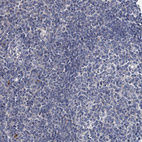 Immunohistochemical staining of human Tonsil shows no positivity in germinal center cells as expected.