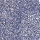 Immunohistochemical staining of human Tonsil shows no positivity in germinal center cells as expected.