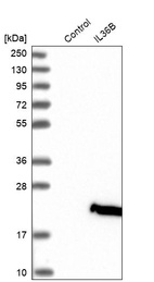 Anti-IL36B Antibody
