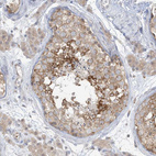 Anti-RPP40 Antibody
