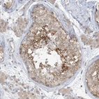 Anti-RPP40 Antibody