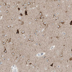 Immunohistochemical staining of human cerebral cortex shows strong cytoplasmic positivity in neurons.