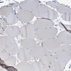 Immunohistochemical staining of human skeletal muscle shows no positivity in myocytes as expected.