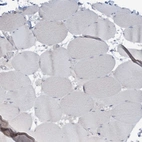 Immunohistochemical staining of human skeletal muscle shows no positivity in myocytes as expected.