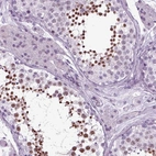 Immunohistochemical staining of human testis shows strong nuclear positivity in cells in seminiferous ducts.