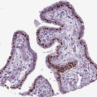 Immunohistochemical staining of human fallopian tube shows moderate nuclear positivity in glandular cells.
