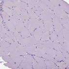 Immunohistochemical staining of human skeletal muscle shows no positivity in myocytes as expected.