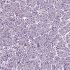 Immunohistochemical staining of human pancreas shows no positivity in exocrine glandular cells as expected.