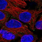 Anti-ANKRD6 Antibody