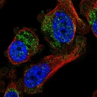 Immunofluorescent staining of human cell line PC-3 shows localization to cytosol.