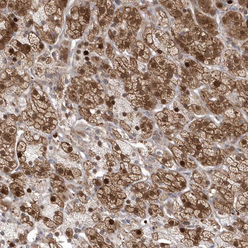 Anti-GEMIN6 Antibody