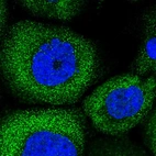 Immunofluorescent staining of human cell line A-431 shows positivity in cytoplasm.