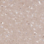 Anti-SERINC1 Antibody