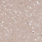 Anti-SERINC1 Antibody