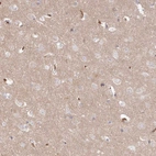 Anti-SERINC1 Antibody