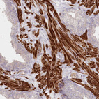 Anti-SERINC1 Antibody