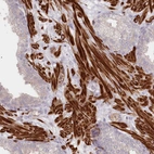 Immunohistochemical staining of human prostate shows strong cytoplasmic positivity in smooth muscle cells.