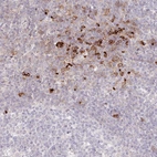 Immunohistochemical staining of human tonsil shows strong cytoplasmic positivity in non-germinal center cells.