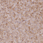 Immunohistochemical staining of human liver shows moderate cytoplasmic positivity in hepatocytes.