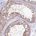 Anti-LRRC34 Antibody