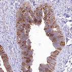 Immunohistochemical staining of human fallopian tube shows moderate membranous and cytoplasmic positivity in glandular cells.