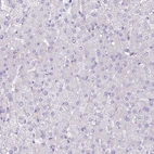 Immunohistochemical staining of human liver shows no positivity in hepatocytes as expected.