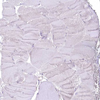 Immunohistochemical staining of human skeletal muscle shows no positivity in myocytes as expected.