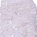 Immunohistochemical staining of human skeletal muscle shows no positivity in myocytes as expected.