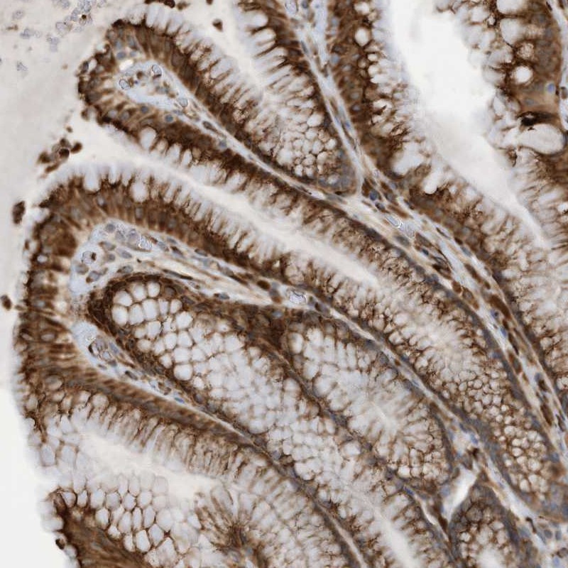 Anti-ZBTB45 Antibody