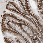 Anti-ZBTB45 Antibody