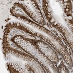 Anti-ZBTB45 Antibody