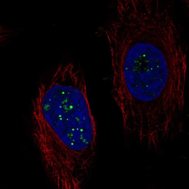 Anti-C6orf223 Antibody