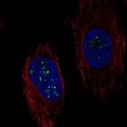 Anti-C6orf223 Antibody