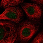 Immunofluorescent staining of human cell line A-431 shows positivity in centrosome & nucleus but excluded from the nucleoli.