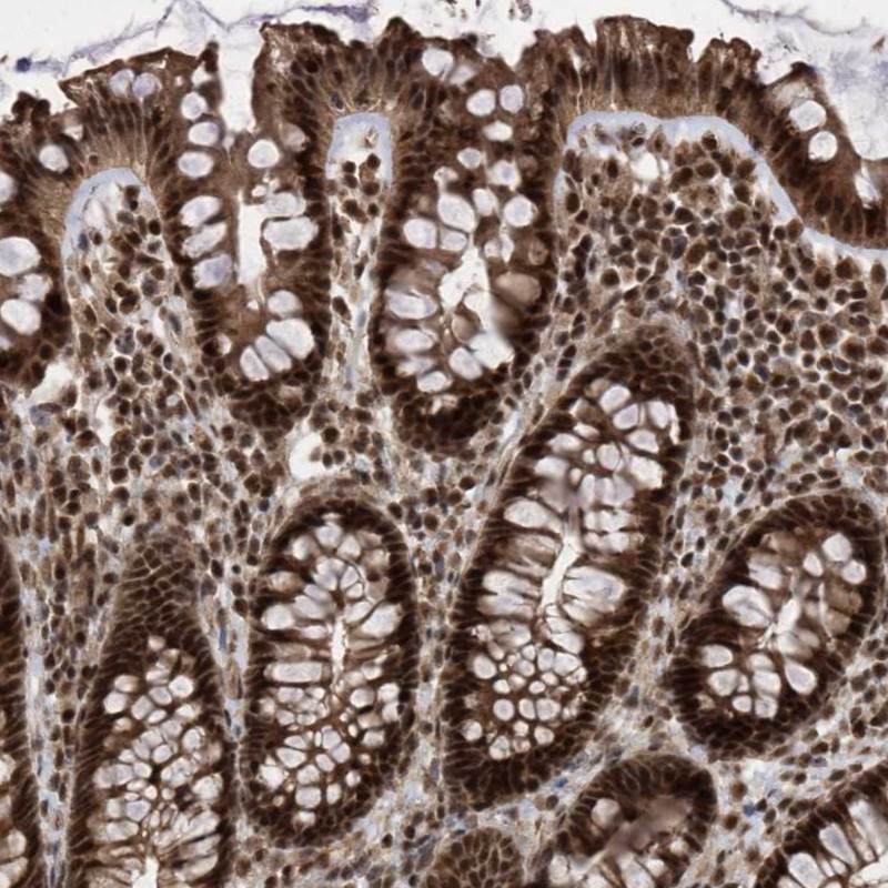Anti-INTS12 Antibody