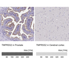 Anti-TMPRSS2 Antibody