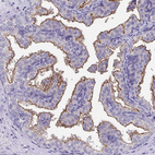 Anti-TMPRSS2 Antibody