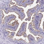 Immunohistochemical staining of human prostate shows strong membranous positivity in glandular cells.