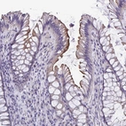 Immunohistochemical staining of human rectum shows moderate membranous positivity in glandular cells.