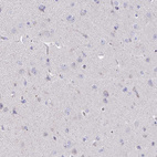 Immunohistochemical staining of human cerebral cortex shows no positivity in neurons as expected.