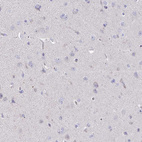 Anti-TMPRSS2 Antibody