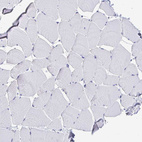 Immunohistochemical staining of human skeletal muscle shows no positivity in myocytes as expected.