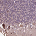 Anti-PCDHA12 Antibody