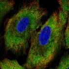 Immunofluorescent staining of human cell line A549 shows localization to cytosol.