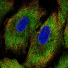 Immunofluorescent staining of human cell line A549 shows localization to cytosol.