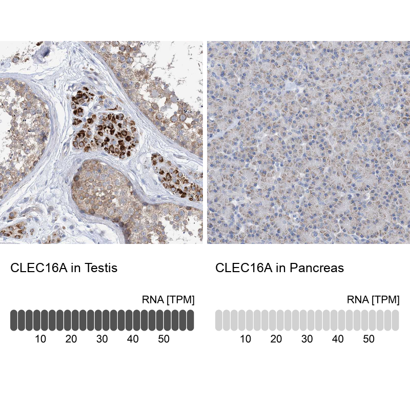 Anti-CLEC16A Antibody