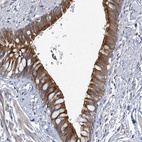 Anti-CLEC16A Antibody