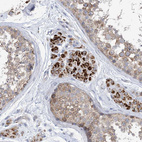 Immunohistochemical staining of human testis shows strong cytoplasmic positivity in Leydig cells.
