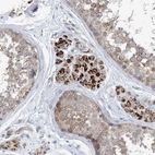 Immunohistochemical staining of human testis shows strong cytoplasmic positivity in Leydig cells.