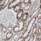 Immunohistochemical staining of human kidney shows strong cytoplasmic positivity in cells in tubules.